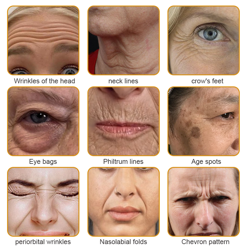 šØāāļøšMade and Shipped from the USAā
BBOJI⢠Botulinum Bienengift Wrinkle Removal Cream-Last Day Promotion 70% OFF