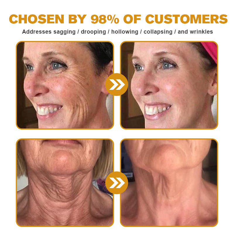 šØāāļøšMade and Shipped from the USAā
BBOJI⢠Botulinum Bienengift Wrinkle Removal Cream-Last Day Promotion 70% OFF