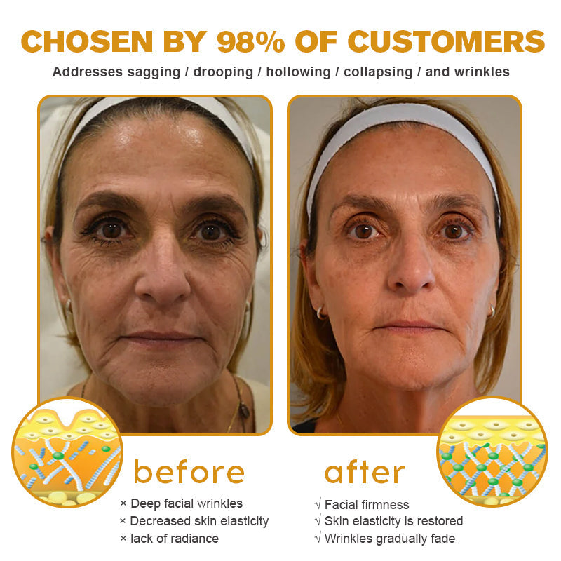 šØāāļøšMade and Shipped from the USAā
BBOJI⢠Botulinum Bienengift Wrinkle Removal Cream-Last Day Promotion 70% OFF