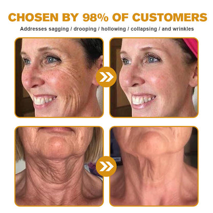 ⭐🌙🔥👨‍⚕️💐Made and Shipped from the USA✅ BBOJI™ Botulinum Bienengift Wrinkle Removal Cream-Last Day Promotion 70% OFF