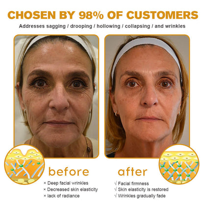 ⭐🌙🔥👨‍⚕️💐Made and Shipped from the USA✅ BBOJI™ Botulinum Bienengift Wrinkle Removal Cream-Last Day Promotion 70% OFF